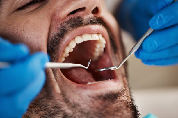 Best Emergency Dental Care for Sports Injuries in Ackley, IA